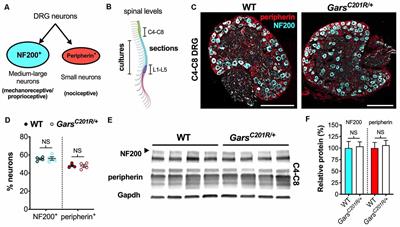 Altered Sensory Neuron Development in CMT2D Mice Is Site-Specific and Linked to Increased GlyRS Levels